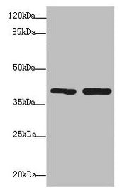 Western blot  | All lanes: PDCD2L antibody at 1.69µg/ml  | Lane 1: Hela whole cell lysate  | Lane 2: MCF-7 whole cell lysate  | Secondary  | Goat polyclonal to rabbit IgG at 1/10000 dilution  | Predicted band size: 39 kDa  | Observed band size: 39 kDaRabbit anti-Human PDCD2L Polyclonal Antibody