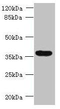Western blot  | All lanes: TRIM51 antibody at 1.2µg/ml + Jurkat whole cell lysate  | Secondary  | Goat polyclonal to rabbit IgG at 1/10000 dilution  | Predicted band size: 53, 36 kDa  | Observed band size: 36 kDaRabbit anti-Human TRIM51 Polyclonal Antibody