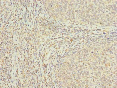 Immunohistochemistry of paraffin-embedded human tonsil tissue using MED18 Antibody at dilution of 1:100