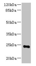 Western blot  | All lanes: MED18 antibody at 0.8µg/ml + 293T whole cell lysate  | Secondary  | Goat polyclonal to rabbit IgG at 1/10000 dilution  | Predicted band size: 24 kDa  | Observed band size: 24 kDa