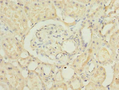 Immunohistochemistry of paraffin-embedded human kidney tissue using RUSC1 Antibody at dilution of 1:100Rabbit anti-Human RUSC1 Polyclonal Antibody