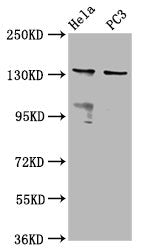 Western Blot  | Positive WB detected in: Hela whole cell lysate, PC-3 whole cell lysate  | All lanes: MOV10L1 antibody at 6.5µg/ml  | Secondary  | Goat polyclonal to rabbit IgG at 1/50000 dilution  | Predicted band size: 136, 38, 14, 130, 131 kDa  | Observed band size: 136 kDa