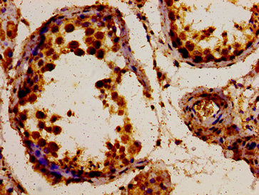 Immunohistochemistry of paraffin-embedded human testis tissue using POLDIP3 Antibody at dilution of 1:100Rabbit anti-Human POLDIP3 Polyclonal Antibody