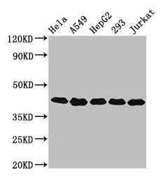 Western Blot | Positive WB detected in: Hela whole cell lysate, A549 whole cell lysate, HepG2 whole cell lysate, 293 whole cell lysate, Jurkat whole cell lysate | All lanes: POLDIP3 antibody at 3.2μg/ml | Secondary | Goat polyclonal to rabbit IgG at 1/50000 dilution | Predicted band size: 47, 43 kDa | Observed band size: 43 kDaRabbit anti-Human POLDIP3 Polyclonal Antibody