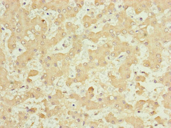 Immunohistochemistry of paraffin-embedded human liver tissue using NUF2 Antibody at dilution of 1:100Rabbit anti-Human NUF2 Polyclonal Antibody