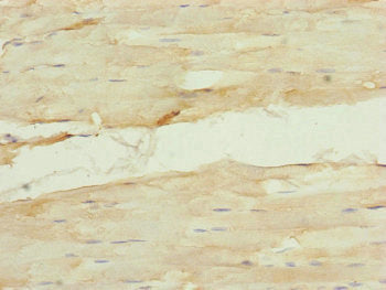 Immunohistochemistry of paraffin-embedded human skeletal muscle tissue using NUF2 Antibody at dilution of 1:100Rabbit anti-Human NUF2 Polyclonal Antibody