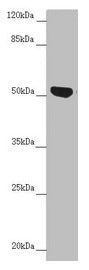 Western blot  | All lanes: NUF2 antibody at 5.29µg/ml + Jurkat whole cell lysate  | Secondary  | Goat polyclonal to rabbit IgG at 1/10000 dilution  | Predicted band size: 54 kDa  | Observed band size: 54 kDaRabbit anti-Human NUF2 Polyclonal Antibody