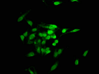 Immunofluorescence staining of Hela cells with TNKS1BP1 Antibody at 1:100, counter-stained with DAPI. The cells were fixed in 4% formaldehyde, permeabilized using 0.2% Triton X-100 and blocked in 10% normal Goat Serum. The cells were then incubated with the antibody overnight at 4°C. The secondary antibody was Alexa Fluor 488-congugated AffiniPure Goat Anti-Rabbit IgG(H+L).Rabbit anti-Human TNKS1BP1 Polyclonal Antibody