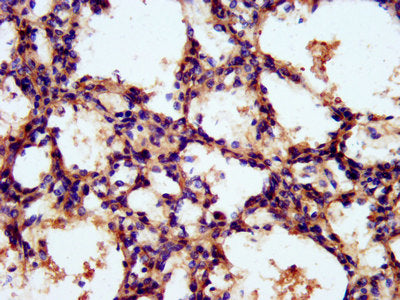 IHC image of the antibody diluted at 1:300 and staining in paraffin-embedded human lung tissue performed on a Leica BondTM system. After dewaxing and hydration, antigen retrieval was mediated by high pressure in a citrate buffer (pH 6.0). Section was blocked with 10% normal goat serum 30min at RT. Then primary antibody (1% BSA) was incubated at 4°C overnight. The primary is detected by a biotinylated secondary antibody and visualized using an HRP conjugated SP system.Rabbit anti-Human TNKS1BP1 Polyclonal Antibody