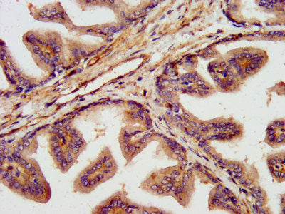 IHC image of TNKS1BP1 Antibody diluted at 1:300 and staining in paraffin-embedded human prostate tissue performed on a Leica BondTM system. After dewaxing and hydration, antigen retrieval was mediated by high pressure in a citrate buffer (pH 6.0). Section was blocked with 10% normal goat serum 30min at RT. Then primary antibody (1% BSA) was incubated at 4°C overnight. The primary is detected by a biotinylated secondary antibody and visualized using an HRP conjugated SP system.Rabbit anti-Human TNKS1BP1 Polyclonal Antibody