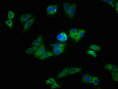 Immunofluorescence staining of HepG2 cells with SNX5 Antibody at 1:213, counter-stained with DAPI. The cells were fixed in 4% formaldehyde, permeabilized using 0.2% Triton X-100 and blocked in 10% normal Goat Serum. The cells were then incubated with the antibody overnight at 4°C. The secondary antibody was Alexa Fluor 488-congugated AffiniPure Goat Anti-Rabbit IgG(H+L).Rabbit anti-Human SNX5 Polyclonal Antibody
