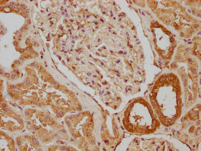 IHC image of the antibody diluted at 1:640 and staining in paraffin-embedded human kidney tissue performed on a Leica BondTM system. After dewaxing and hydration, antigen retrieval was mediated by high pressure in a citrate buffer (pH 6.0). Section was blocked with 10% normal goat serum 30min at RT. Then primary antibody (1% BSA) was incubated at 4°C overnight. The primary is detected by a biotinylated secondary antibody and visualized using an HRP conjugated SP system.Rabbit anti-Human SNX5 Polyclonal Antibody