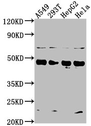 Western Blot | Positive WB detected in: A549 whole cell lysate, 293T whole cell lysate, HepG2 whole cell lysate, Hela whole cell lysate | All lanes: SNX5 antibody at 1:2000 | Secondary | Goat polyclonal to rabbit IgG at 1/50000 dilution | Predicted band size: 47, 14 kDa | Observed band size: 47 kDaRabbit anti-Human SNX5 Polyclonal Antibody