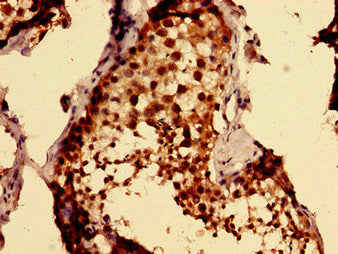 Immunohistochemistry of paraffin-embedded human testis tissue using MKRN2 Antibody at dilution of 1:100