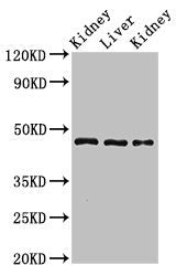 Western Blot | Positive WB detected in: Rat kidney tissue, Rat liver tissue, Mouse kidney tissue | All lanes: MKRN2 antibody at 3μg/ml | Secondary | Goat polyclonal to rabbit IgG at 1/50000 dilution | Predicted band size: 47, 42 kDa | Observed band size: 47 kDa