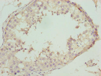Immunohistochemistry of paraffin-embedded human testis tissue using NBPF3 Antibody at dilution of 1:100Rabbit anti-Human NBPF3 Polyclonal Antibody