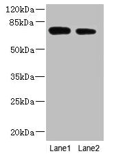 Western blot  | All lanes: NBPF3 antibody at 1.2µg/ml  | Lane 1: PC-3 whole cell lysate  | Lane 2: HT29 whole cell lysate  | Secondary  | Goat polyclonal to rabbit IgG at 1/10000 dilution  | Predicted band size: 73, 68, 72, 33, 66 kDa  | Observed band size: 73 kDaRabbit anti-Human NBPF3 Polyclonal Antibody
