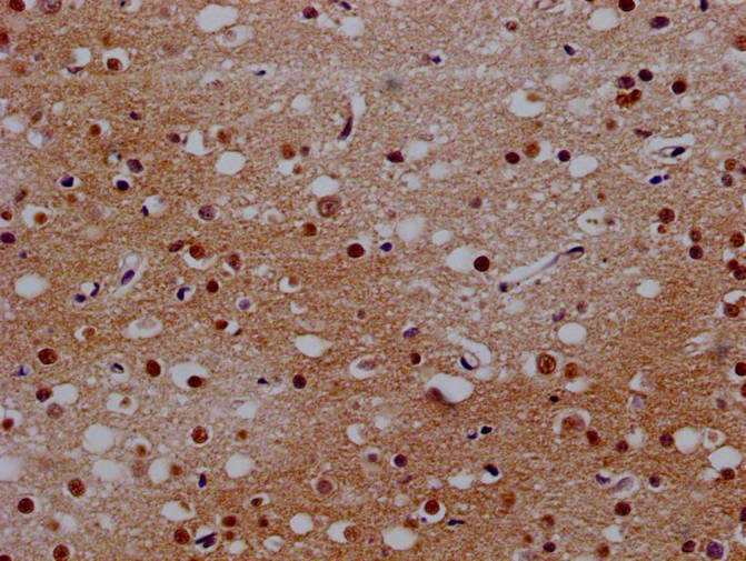 Immunohistochemistry of paraffin-embedded human brain tissue using BCL11A Antibody at dilution of 1:100