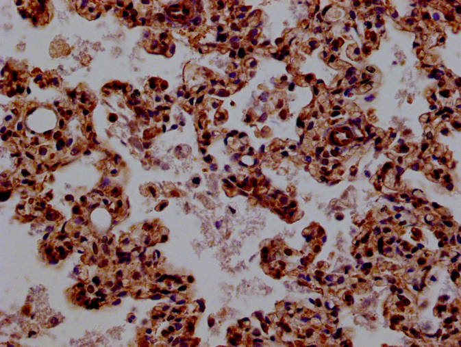 Immunohistochemistry of paraffin-embedded human lung tissue using BCL11A Antibody at dilution of 1:100