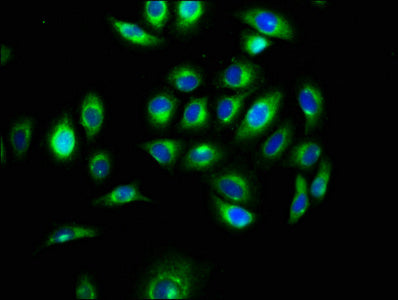 Immunofluorescence staining of A549 cells with MEGF9 Antibody at 1:100, counter-stained with DAPI. The cells were fixed in 4% formaldehyde, permeabilized using 0.2% Triton X-100 and blocked in 10% normal Goat Serum. The cells were then incubated with the antibody overnight at 4°C. The secondary antibody was Alexa Fluor 488-congugated AffiniPure Goat Anti-Rabbit IgG(H+L).