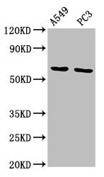 Western Blot | Positive WB detected in: A549 whole cell lysate, PC-3 whole cell lysate | All lanes: MEGF9 antibody at 11.5μg/ml | Secondary | Goat polyclonal to rabbit IgG at 1/50000 dilution | Predicted band size: 63 kDa | Observed band size: 63 kDa