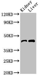 Western Blot | Positive WB detected in: Mouse kidney tissue, Mouse liver tissue | All lanes: BLZF1 antibody at 3μg/ml | Secondary | Goat polyclonal to rabbit IgG at 1/50000 dilution | Predicted band size: 45, 20 kDa | Observed band size: 45 kDa