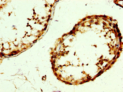 IHC image of RAB3GAP2 Antibody diluted at 1:300 and staining in paraffin-embedded human testis tissue performed on a Leica BondTM system. After dewaxing and hydration, antigen retrieval was mediated by high pressure in a citrate buffer (pH 6.0). Section was blocked with 10% normal goat serum 30min at RT. Then primary antibody (1% BSA) was incubated at 4°C overnight. The primary is detected by a biotinylated secondary antibody and visualized using an HRP conjugated SP system.Rabbit anti-Human RAB3GAP2 Polyclonal Antibody