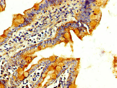IHC image of RAB3GAP2 Antibody diluted at 1:300 and staining in paraffin-embedded human small intestine tissue performed on a Leica BondTM system. After dewaxing and hydration, antigen retrieval was mediated by high pressure in a citrate buffer (pH 6.0). Section was blocked with 10% normal goat serum 30min at RT. Then primary antibody (1% BSA) was incubated at 4°C overnight. The primary is detected by a biotinylated secondary antibody and visualized using an HRP conjugated SP system.Rabbit anti-Human RAB3GAP2 Polyclonal Antibody