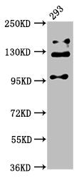 Western Blot | Positive WB detected in: 293 whole cell lysate | All lanes: RAB3GAP2 antibody at 5μg/ml | Secondary | Goat polyclonal to rabbit IgG at 1/50000 dilution | Predicted band size: 156, 24 kDa | Observed band size: 110, 130, 150 kDaRabbit anti-Human RAB3GAP2 Polyclonal Antibody
