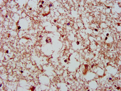 IHC image of GHITM Antibody diluted at 1:400 and staining in paraffin-embedded human brain tissue performed on a Leica BondTM system. After dewaxing and hydration, antigen retrieval was mediated by high pressure in a citrate buffer (pH 6.0). Section was blocked with 10% normal goat serum 30min at RT. Then primary antibody (1% BSA) was incubated at 4°C overnight. The primary is detected by a biotinylated secondary antibody and visualized using an HRP conjugated SP system.Rabbit anti-Human GHITM Polyclonal Antibody