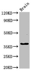 Western Blot  | Positive WB detected in: Rat brain tissue  | All lanes: GHITM antibody at 2.7µg/ml  | Secondary  | Goat polyclonal to rabbit IgG at 1/50000 dilution  | Predicted band size: 38 kDa  | Observed band size: 38 kDaRabbit anti-Human GHITM Polyclonal Antibody