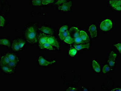 Immunofluorescent analysis of MCF-7 cells using HIPK3 Antibody at dilution of 1:100 and Alexa Fluor 488-congugated AffiniPure Goat Anti-Rabbit IgG(H+L)Rabbit anti-Human HIPK3 Polyclonal Antibody