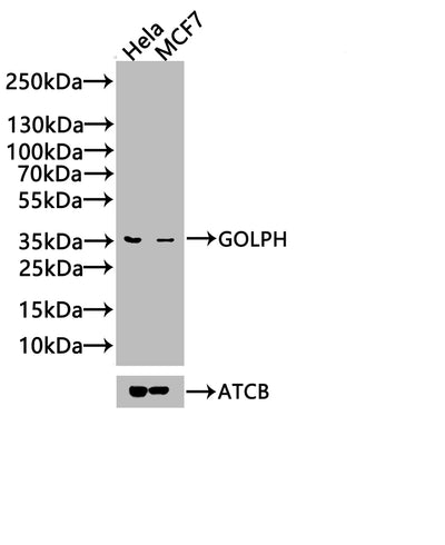 Western Blot  | Positive WB detected in: Hela whole cell lysate, 293 whole cell lysate, A549 whole cell lysate  | All lanes: GOLPH3 antibody at 3.2µg/ml  | Secondary  | Goat polyclonal to rabbit IgG at 1/50000 dilution  | Predicted band size: 34 kDa  | Observed band size: 34 kDaRabbit anti-Human GOLPH3 Polyclonal Antibody