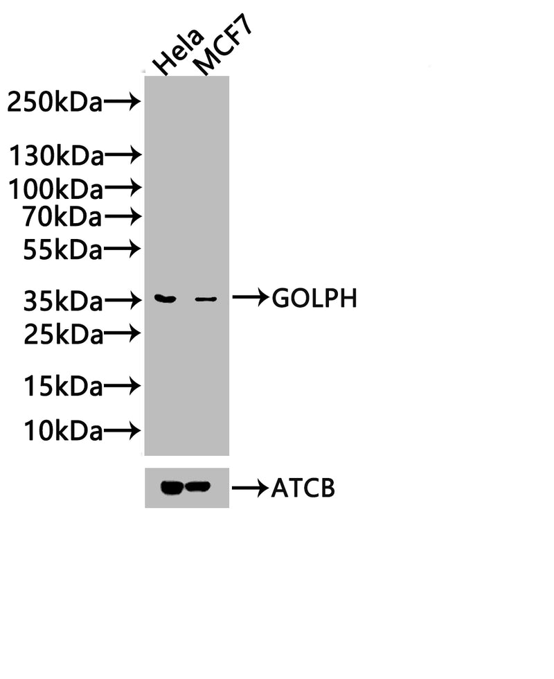 Western Blot  | Positive WB detected in: Hela whole cell lysate, 293 whole cell lysate, A549 whole cell lysate  | All lanes: GOLPH3 antibody at 3.2µg/ml  | Secondary  | Goat polyclonal to rabbit IgG at 1/50000 dilution  | Predicted band size: 34 kDa  | Observed band size: 34 kDaRabbit anti-Human GOLPH3 Polyclonal Antibody
