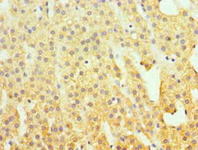 Immunohistochemistry of paraffin-embedded human adrenal gland tissue using SUV39H2 Antibody at dilution of 1:100Rabbit anti-Human SUV39H2 Polyclonal Antibody