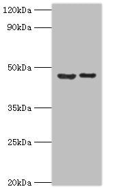 Western blot | All lanes: Histone-lysine N-methyltransferase SUV39H2 antibody at 0.32μg/ml | Lane 1: HepG2 whole cell lysate | Lane 2: Hela whole cell lysate | Secondary | Goat polyclonal to rabbit IgG at 1/10000 dilution | Predicted band size: 47, 40, 27 kDa | Observed band size: 47 kDaRabbit anti-Human SUV39H2 Polyclonal Antibody