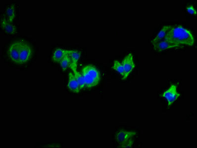 Immunofluorescence staining of HepG2 cells with the antibody at 1:333, counter-stained with DAPI. The cells were fixed in 4% formaldehyde, permeabilized using 0.2% Triton X-100 and blocked in 10% normal Goat Serum. The cells were then incubated with the antibody overnight at 4°C. The secondary antibody was Alexa Fluor 488-congugated AffiniPure Goat Anti-Rabbit IgG(H+L).