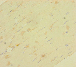 Immunohistochemistry of paraffin-embedded human skeletal muscle tissue using LRRC19 Antibody at dilution of 1:100
