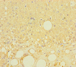 Immunohistochemistry of paraffin-embedded human adrenal gland tissue using LRRC19 Antibody at dilution of 1:100
