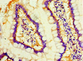 Immunohistochemistry of paraffin-embedded human small intestine tissue using the antibody at dilution of 1:100Rabbit anti-Human MOB1A Polyclonal Antibody