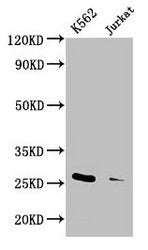 Western Blot  | Positive WB detected in: K562 whole cell lysate, Jurkat whole cell lysate  | All lanes: MOB1A antibody at 3.3µg/ml  | Secondary  | Goat polyclonal to rabbit IgG at 1/50000 dilution  | Predicted band size: 26, 17 kDa  | Observed band size: 26 kDaRabbit anti-Human MOB1A Polyclonal Antibody