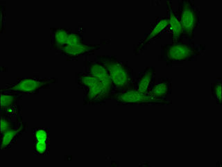Immunofluorescent analysis of Hela cells using COPS7B Antibody at dilution of 1:100 and Alexa Fluor 488-congugated AffiniPure Goat Anti-Rabbit IgG(H+L)Rabbit anti-Human COPS7B Polyclonal Antibody