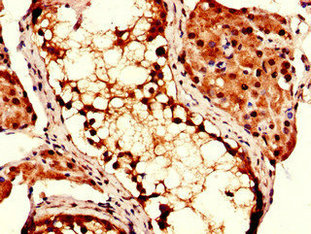 Immunohistochemistry of paraffin-embedded human testis tissue using COPS7B Antibody at dilution of 1:100Rabbit anti-Human COPS7B Polyclonal Antibody