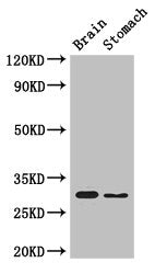 Western Blot  | Positive WB detected in: Mouse brain tissue, Mouse stomach tissue  | All lanes: COPS7B antibody at 3µg/ml  | Secondary  | Goat polyclonal to rabbit IgG at 1/50000 dilution  | Predicted band size: 30, 19, 31 kDa  | Observed band size: 30 kDaRabbit anti-Human COPS7B Polyclonal Antibody