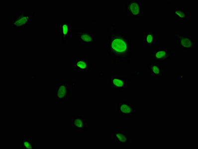 Immunofluorescence staining of U251 cells with CACYBP Antibody at 1:133, counter-stained with DAPI. The cells were fixed in 4% formaldehyde, permeabilized using 0.2% Triton X-100 and blocked in 10% normal Goat Serum. The cells were then incubated with the antibody overnight at 4°C. The secondary antibody was Alexa Fluor 488-congugated AffiniPure Goat Anti-Rabbit IgG(H+L).