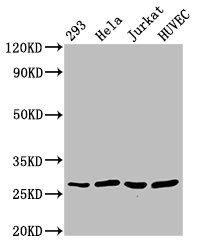 Western Blot | Positive WB detected in: 293 whole cell lysate, Hela whole cell lysate, Jurkat whole cell lysate, HUVEC whole cell lysate | All lanes: CACYBP antibody at 2.7μg/ml | Secondary | Goat polyclonal to rabbit IgG at 1/50000 dilution | Predicted band size: 27, 9, 22 kDa | Observed band size: 27 kDa