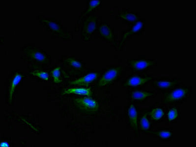 Immunofluorescent analysis of Hela cells using ADGRL4 Antibody at dilution of 1:100 and Alexa Fluor 488-congugated AffiniPure Goat Anti-Rabbit IgG(H+L)Rabbit anti-Human ADGRL4 Polyclonal Antibody