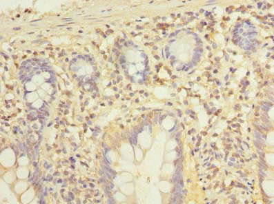 Immunohistochemistry of paraffin-embedded human small intestine tissue using ADGRL4 Antibody at dilution of 1:100Rabbit anti-Human ADGRL4 Polyclonal Antibody