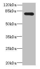 Western blot  | All lanes: ADGRL4 antibody at 4µg/ml + Hela whole cell lysate  | Secondary  | Goat polyclonal to rabbit IgG at 1/10000 dilution  | Predicted band size: 78 kDa  | Observed band size: 78 kDa