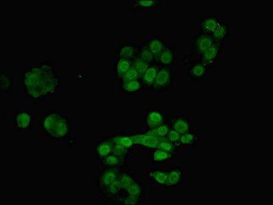Immunofluorescent analysis of PC-3 cells using RAVER2 Antibody at dilution of 1:100 and Alexa Fluor 488-congugated AffiniPure Goat Anti-Rabbit IgG(H+L)Rabbit anti-Human RAVER2 Polyclonal Antibody